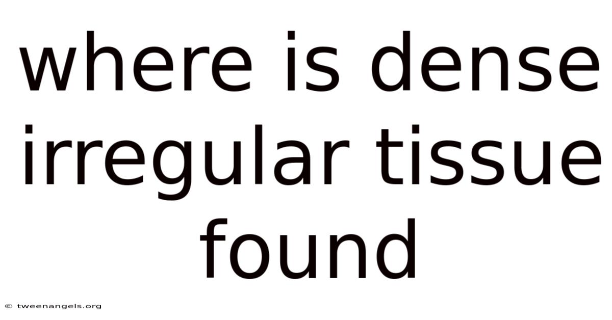 Where Is Dense Irregular Tissue Found