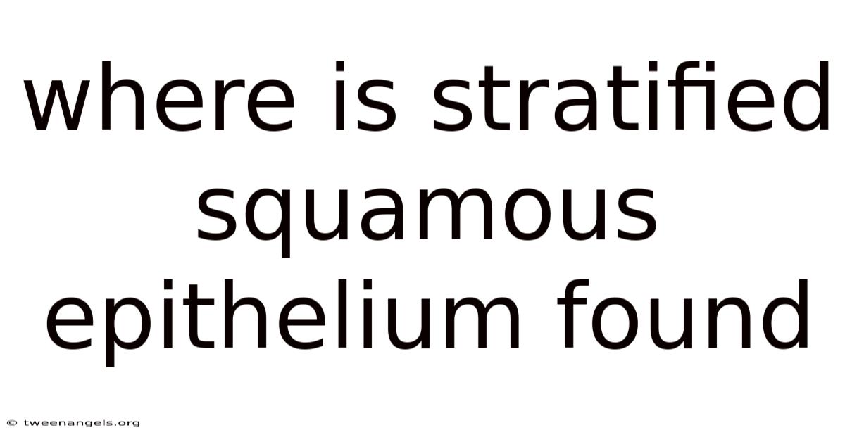 Where Is Stratified Squamous Epithelium Found